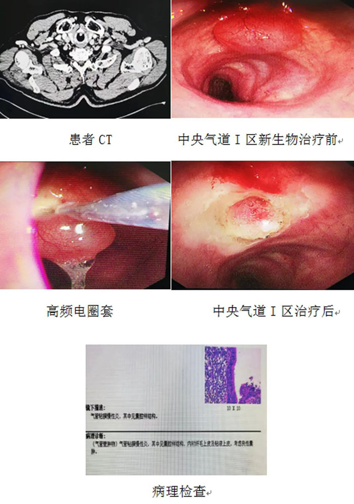 1678774340113420.jpg W020230309582099679982.jpg