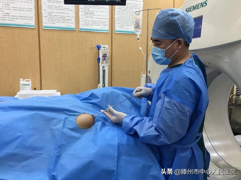 CT引導(dǎo)微波消融聯(lián)合鋼筋混凝土技術(shù)治療肱骨轉(zhuǎn)移技術(shù)在滕州開展